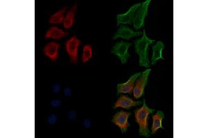 ABIN6256204 and ABIN6267563 staining HepG2 cells(30 min of 4uM Forskolin treatment) by IF/ICC. (RPS6 抗体  (pSer235))