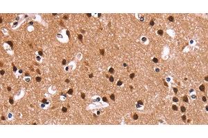 Immunohistochemistry of paraffin-embedded Human brain using RPSA Polyclonal Antibody at dilution of 1:60 (RPSA/Laminin Receptor 抗体)