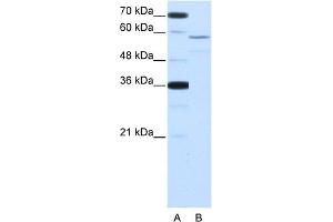 WB Suggested Anti-NOVA2 Antibody Titration:  2. (NOVA2 抗体  (Middle Region))
