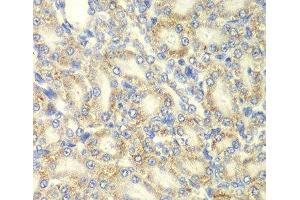 Immunohistochemistry of paraffin-embedded Rat kidney using PRKAB2 Polyclonal Antibody at dilution of 1:100 (40x lens). (PRKAB2 抗体)
