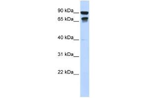 WB Suggested Anti-MSL3L1 Antibody Titration:  0. (MSL3 抗体  (N-Term))