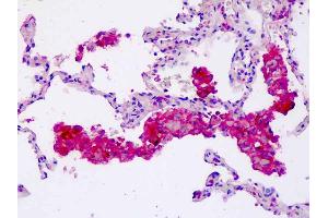 Anti-CORO6 antibody IHC staining of human lung, macrophages. (Coronin 6 抗体  (AA 337-365))