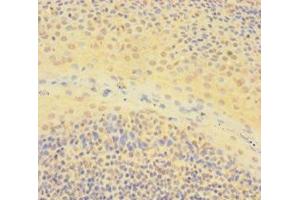 Immunohistochemistry of paraffin-embedded human tonsil tissue using ABIN7150361 at dilution of 1:100 (IKZF1 抗体  (AA 1-265))