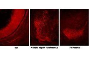 Immunofluorescence (IF) image for anti-Sine Oculis-Related Homeobox 3 (SIX3) (Internal Region) antibody (ABIN6657910)