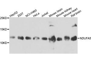 Western blot analysis of extract of various cells, using NDUFA5 antibody. (NDUFA5 抗体)