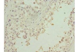 Immunohistochemistry of paraffin-embedded human testis tissue using ABIN7176258 at dilution of 1:100 (ZNF35 抗体  (AA 233-532))