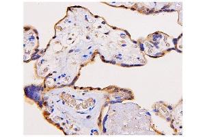 IHC analysis of ADK using anti-ADK antibody (ABIN7600222). (ADK 抗体  (AA 165-351))