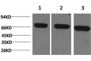 Western Blot analysis of 1) Hela, 2)Mouse brain, 3) Rat brain using HSPA8 Monoclonal Antibody at dilution of 1:2000. (Hsc70 抗体)
