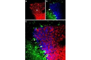 Expression of GABRA6 in mouse cerebellum - Immunohistochemical staining of mouse cerebellum using Anti-GABA(A) α6 Receptor (extracellular) Antibody (ABIN7043190, ABIN7044301 and ABIN7044302).