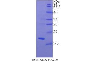 SDS-PAGE analysis of Rat MYL1 Protein. (MYL1 蛋白)