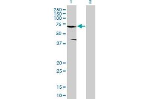 Western Blot analysis of CNKSR3 expression in transfected 293T cell line by CNKSR3 MaxPab polyclonal antibody. (CNKSR3 抗体  (AA 1-555))