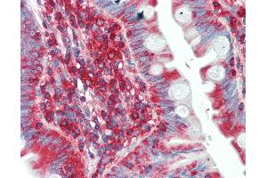 Immunohistochemistry (IHC) image for anti-Sodium Channel, Voltage-Gated, Type I, beta (SCN1B) (AA 110-159) antibody (ABIN6754957)