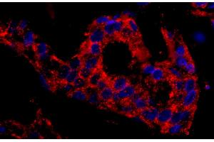 Immunohistochemistry (IHC) image for anti-Sorting Nexin 1 (SNX1) (C-Term) antibody (ABIN7449439) (Sorting Nexin 1 抗体  (C-Term))