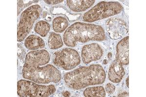 ABIN6266490 at 1/100 staining human kidney tissue sections by IHC-P. (GAB2 抗体  (C-Term))