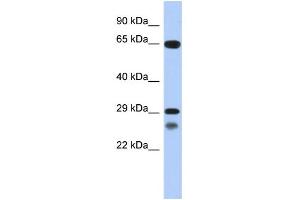 WB Suggested Anti-MYF5 Antibody Titration: 0. (MYF5 抗体  (C-Term))