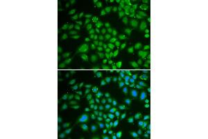 Immunofluorescence analysis of HeLa cells using DCK antibody (ABIN3022557, ABIN3022558, ABIN3022559 and ABIN6218902). (DCK 抗体  (AA 1-260))