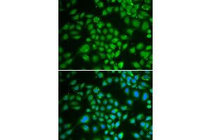 Immunofluorescence analysis of HeLa cells using DCK antibody (ABIN3022557, ABIN3022558, ABIN3022559 and ABIN6218902). (DCK 抗体  (AA 1-260))