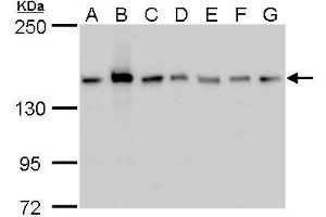 WB Image ROCK2 antibody detects ROCK2 protein by western blot analysis. (ROCK2 抗体)