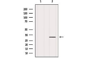 Western Blotting (WB) image for anti-Integrin, alpha X (Complement Component 3 Receptor 4 Subunit) (ITGAX) (N-Term) antibody (ABIN6260570)