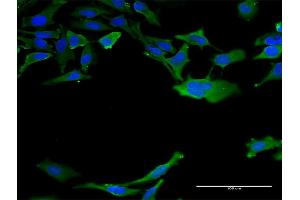 Immunofluorescence of monoclonal antibody to CALM3 on HeLa cell.