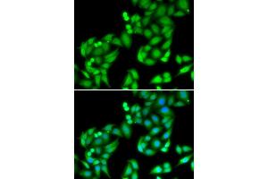 Immunofluorescence analysis of U2OS cells using COPS3 antibody (ABIN5974222). (COPS3 抗体)