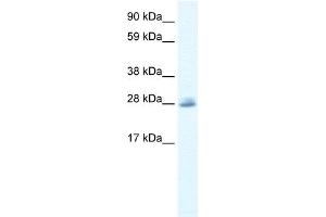 WB Suggested Anti-CLIC5 Antibody Titration:  0. (CLIC5 抗体  (C-Term))