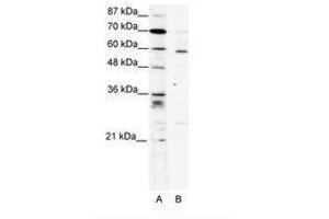 Image no. 1 for anti-PDZ and LIM Domain 5 (PDLIM5) (AA 165-214) antibody (ABIN202009) (PDLIM5 抗体  (AA 165-214))