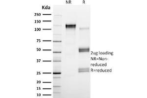 SDS-PAGE Analysis Purified Calpain 1 Mouse Monoclonal Antibody (CAPN1/1530). (CAPNL1 抗体)