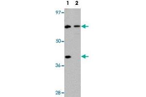 Western blot analysis of TCTN3 in HeLa cell lysate with TCTN3 polyclonal antibody  at (1) 1 and (2) 2ug/mL. (TCTN3 抗体  (C-Term))