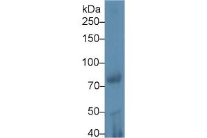Western Blotting (WB) image for anti-Phospholipase A2, Group VI (Cytosolic, Calcium-Independent) (PLA2G6) (AA 481-702) antibody (ABIN7431761)