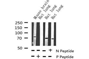 Western Blotting (WB) image for anti-Protein tyrosine Phosphatase, Non-Receptor Type 11 (PTPN11) (pTyr542) antibody (ABIN6256761)