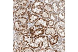 Immunohistochemical staining of human kidney with SLFN12L polyclonal antibody  shows strong cytoplasmic positivity in tubular cells at 1:20-1:50 dilution. (SLFN12L 抗体)