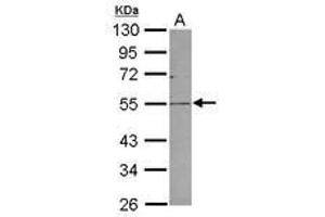 Image no. 1 for anti-Plasmalemma Vesicle Associated Protein (PLVAP) (AA 203-442) antibody (ABIN1500292) (PLVAP 抗体  (AA 203-442))