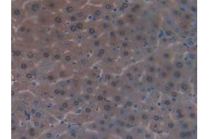 Immunohistochemistry (IHC) image for anti-Glutathione S-Transferase alpha 1 (GSTA1) (AA 2-223) antibody (ABIN1078073)
