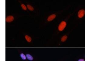Immunofluorescence analysis of U-2 OS cells using FOSL2 Polyclonal Antibody at dilution of 1:100.