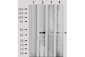Western blot analysis of extracts from various samples, using CBX6 Antibody. (CBX6 抗体  (N-Term))