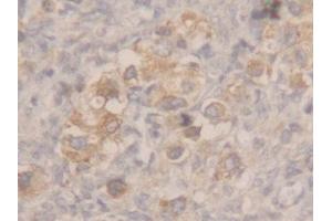 Used in DAB staining on fromalin fixed paraffin-embedded stomach tissue (MSMB 抗体  (AA 19-114))