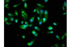 Immunofluorescence (IF) image for anti-V-Akt Murine Thymoma Viral Oncogene Homolog 1 (AKT1) (AA 1-480) antibody (ABIN7167024)