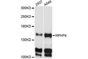 Western blot analysis of extracts of various cell lines, using NPHP4 antibody (ABIN5996805) at 1:3000 dilution. (NPHP4 抗体)