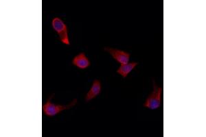 ABIN6261581 and ABIN6272294 staining HepG2 by IF/ICC. (EPS8-Like 3 抗体)