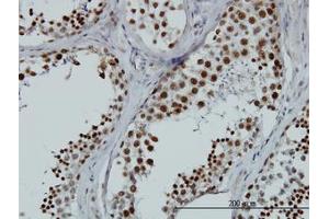 Image no. 1 for anti-RNA Binding Motif Protein, X-Linked-Like 2 (RBMXL2) (AA 1-91) antibody (ABIN599219) (RBMXL2 抗体  (AA 1-91))