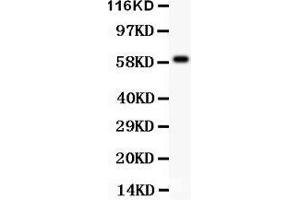 Anti- HRG antibody, Western blotting All lanes: Anti HRG  at 0. (HRG 抗体  (AA 19-200))