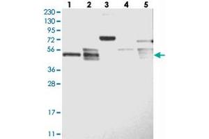 Western blot analysis of Lane 1: RT-4, Lane 2: U-251 MG, Lane 3: Human Plasma, Lane 4: Liver, Lane 5: Tonsil with LACE1 polyclonal antibody . (LACE1 抗体)