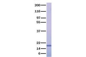Western Blotting (WB) image for Collagen, Type XVIII, alpha 1 (COL18A1) (Transcript Variant 2) (Active) protein (ABIN2712432)