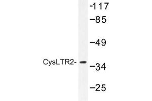 Image no. 1 for anti-Cysteinyl Leukotriene Receptor 2 (CYSLTR2) antibody (ABIN317646) (CasLTR2 抗体)