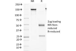 SDS-PAGE Analysis Purified Protocadherin FAT2 Monoclonal Antibody (8C5). (FAT Atypical Cadherin 2 (FAT2) 抗体)