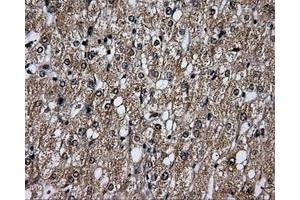 Immunohistochemical staining of paraffin-embedded liver tissue using anti-PLEKmouse monoclonal antibody. (Pleckstrin 抗体)