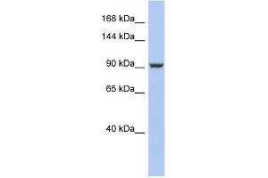 WB Suggested Anti-PMS2 Antibody Titration: 0. (PMS2 抗体  (Middle Region))