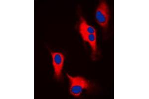 Immunofluorescent analysis of Tyrosine Hydroxylase staining in A549 cells. (Tyrosine Hydroxylase 抗体  (N-Term))