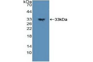 Detection of Recombinant PDPK1, Human using Polyclonal Antibody to Phosphoinositide Dependent Protein Kinase 1 (PDPK1) (PDPK1 抗体  (AA 83-338))